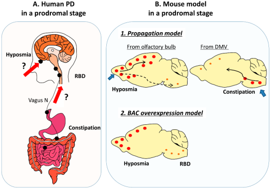 Human Parkinson’s disease (PD) and mouse model in a prodromal stage.