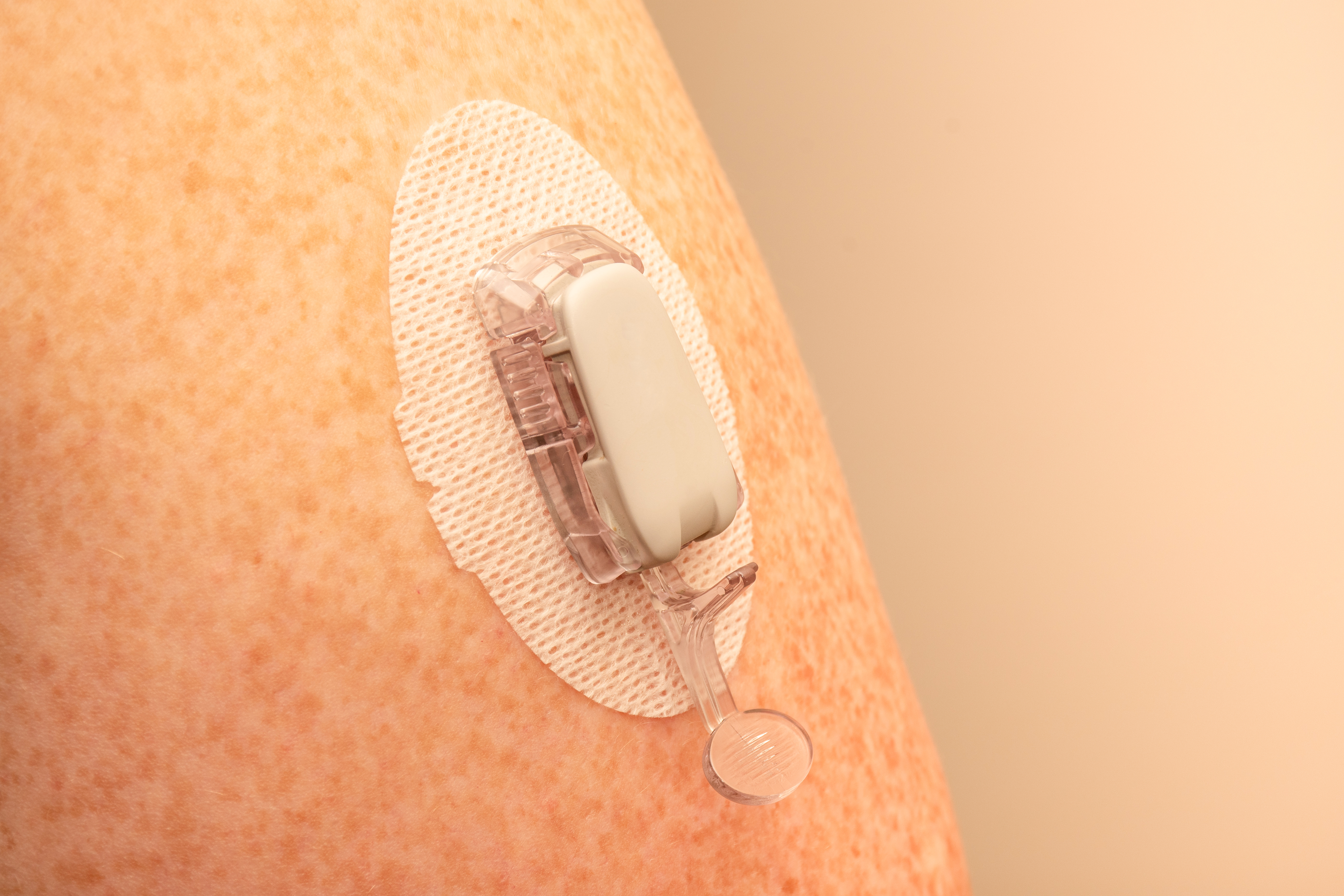 The Benefits of Applying Functional Coatings to Medical Device Surfaces-3